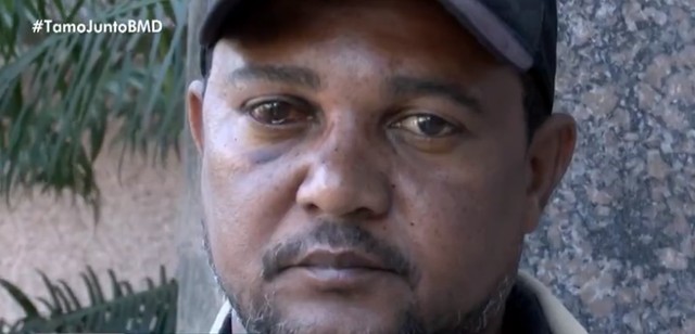 Ex-vereador de Santo Amaro ficou com corpo todo dolorido após agressão de PM's — Foto: Reprodução/ TV Bahia